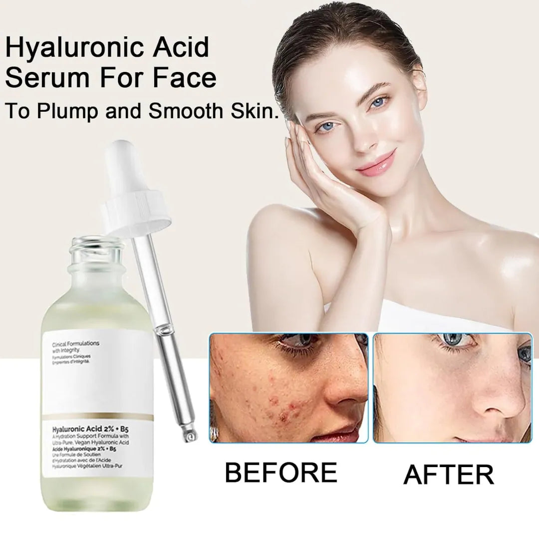 The Ordinary Hyaluronic Acid 2% + B5 Face Moisturizer, Hyaluronic Acid Serum 30ml - Ethixhub pakistan