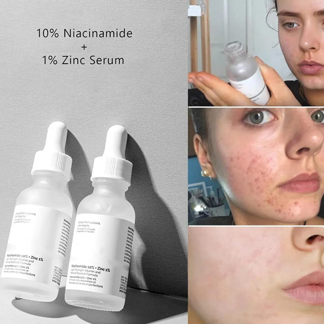 The Ordinary Serum Niacinamide 10% + Zinc 1%