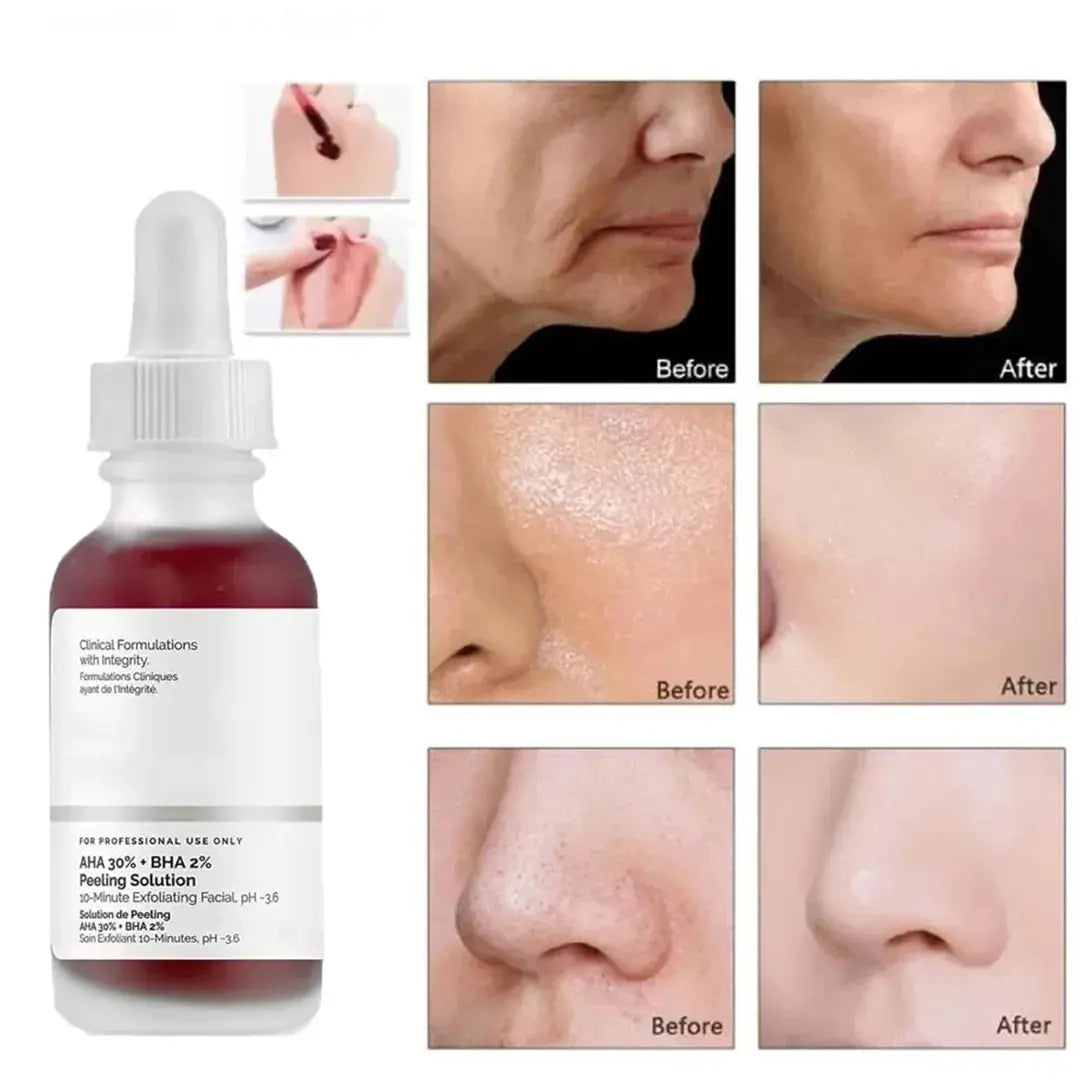 The Ordinary Serum AHA 30% + BHA 2% Peeling Solution 30ml